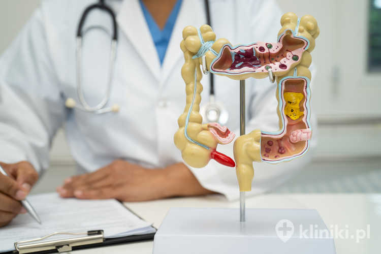 Jelito, wyrostek robaczkowy i układ trawienny, lekarz trzymający model anatomiczny do diagnozowania badań i leczenia w szpitalu