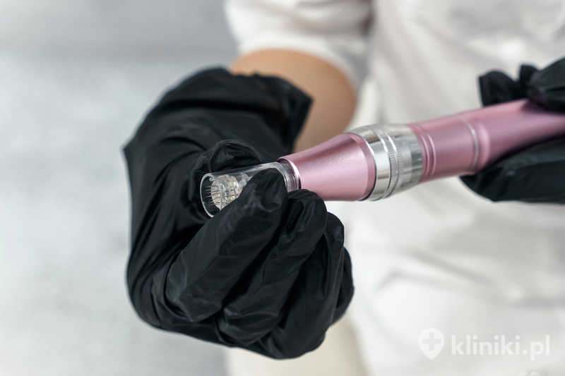 Dermapen - urządzenie do mikrodermabrazji skóry Dermapen - urządzenie do mikrodermabrazji skóry