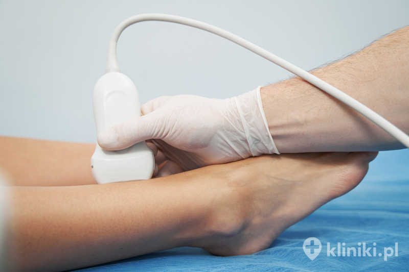Lekarz specjalista wykonujący badanie USG stanu zdrowia żył kończyn dolnych u młodej kobiety Lekarz specjalista wykonujący badanie USG stanu zdrowia żył kończyn dolnych u młodej kobiety