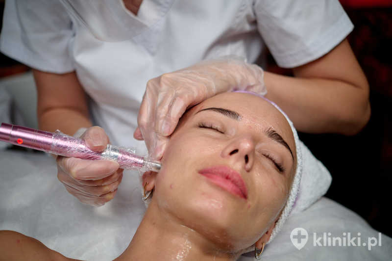 Pielęgnacja przeciwstarzeniowa z dermapenem Pielęgnacja przeciwstarzeniowa z dermapenem
