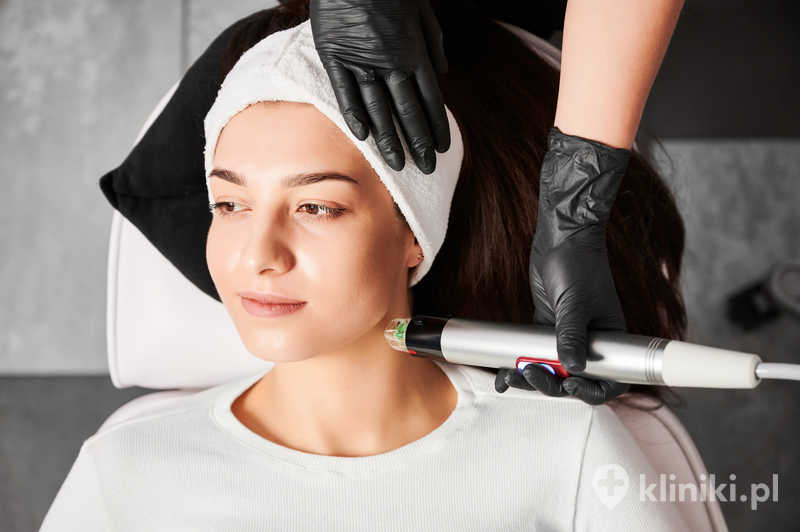 Zabieg Dermapen doskonale rewitalizuje skórę na dekolcie Zabieg Dermapen doskonale rewitalizuje skórę na dekolcie