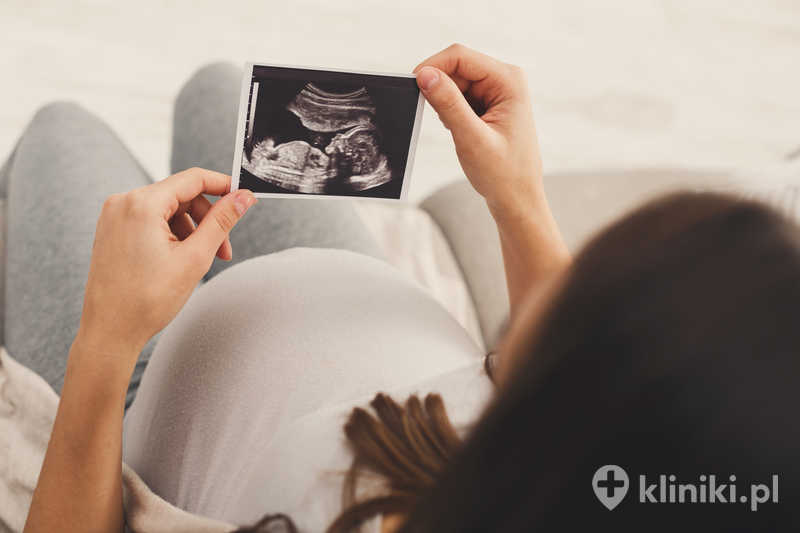 Kobieta w ciąży oglądająca badanie ultrasonograficzne swojego dziecka Kobieta w ciąży oglądająca badanie ultrasonograficzne swojego dziecka