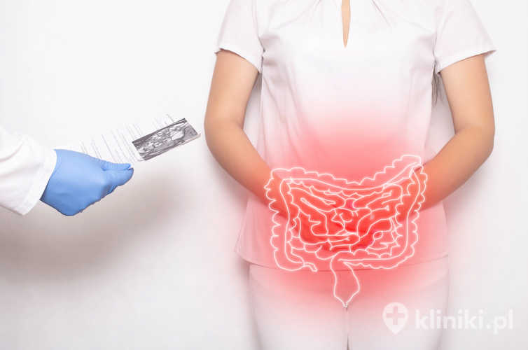 Lekarz trzyma wyniki badania pacjentki. Badanie kapsułką endoskopową. Diagnoza: zapalenie jelit