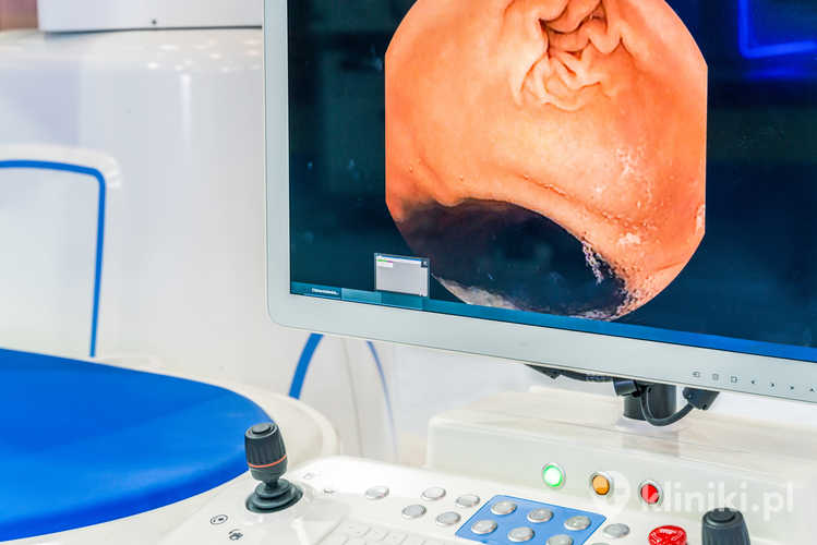 Monitor z widokiem na platformę operacyjną endoskopii kapsułkowej w szpitalu