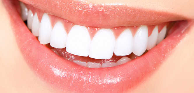 Wybielanie zębów nakładkowe Opalescence