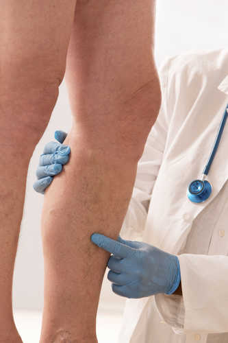 Rola fotopletyzmografii PPG w diagnostyce żył