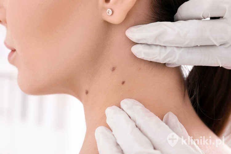Dermatolog badający pacjenta w klinice