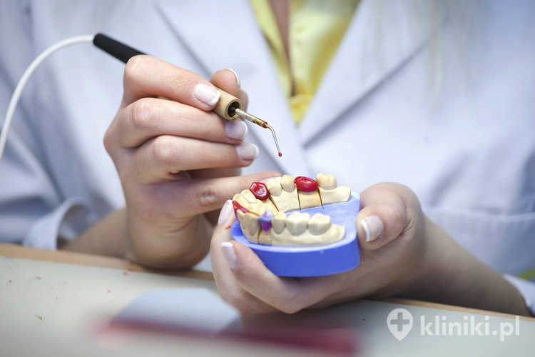 Przeciwwskazania i trwałość implantów