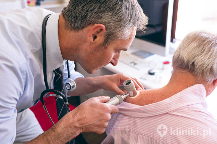 Lekarz bada za pomocą dermatoskopu znamię na plecach kobiety