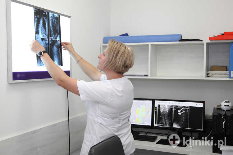Lekarka ogląda zdjęcia skanu MRI żył i tętnic