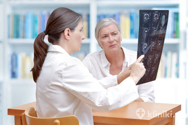 Lekarka omawia ze starszą pacjentką po udarze obrazy z MRI mózgu