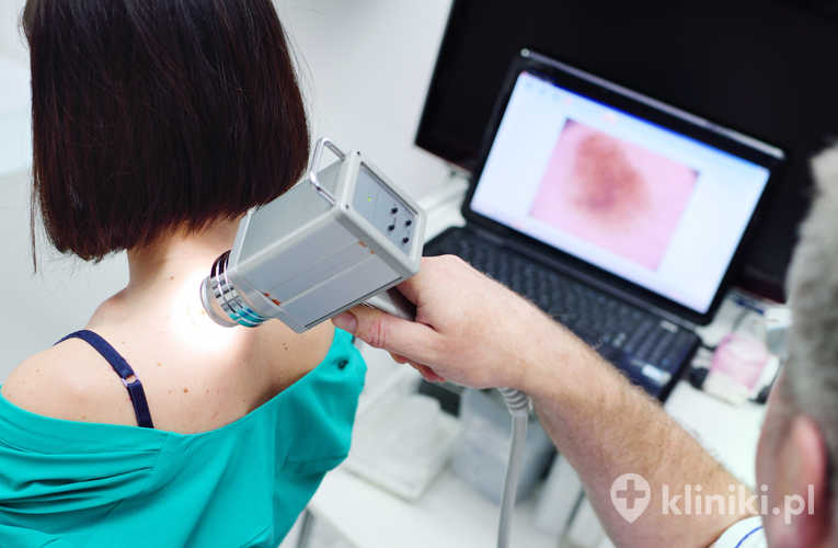 Lekarz bada nowotwory lub znamiona na skórze pacjenta – młodej dziewczyny za pomocą specjalnego aparatu do dermatoskopii – dermoskopu