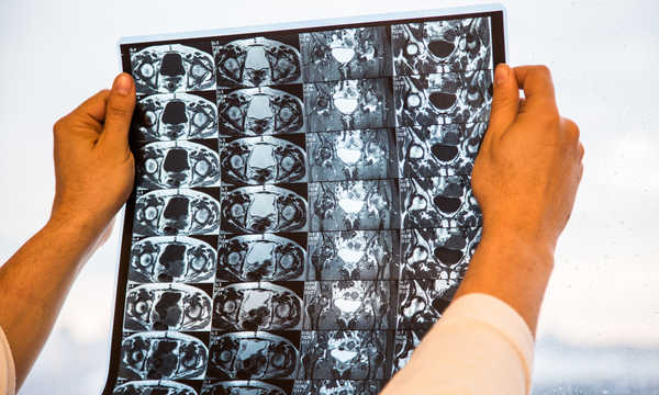 Lekarz bada wyniki rezonansu magnetycznego MRI stawu biodrowego