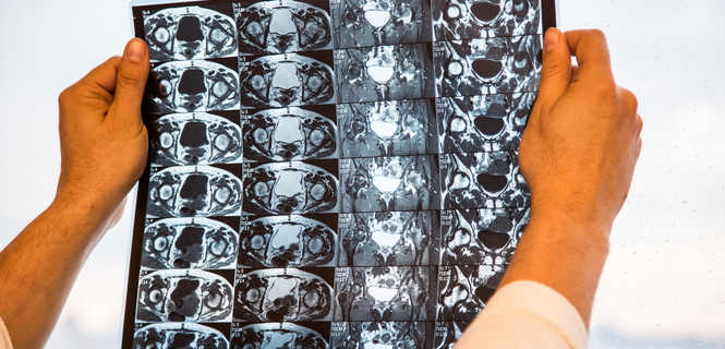 Cholangiografia MR