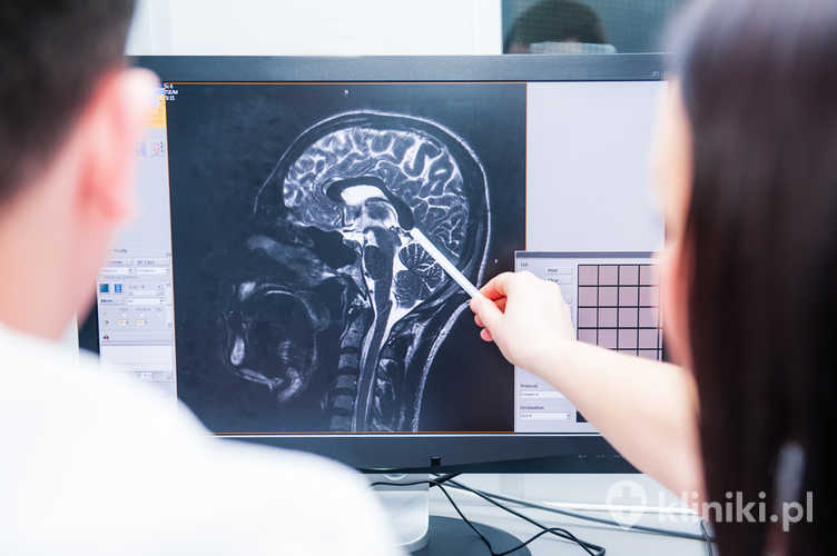Lekarze rozważają i omawiają obraz rezonansu magnetycznego MRI mózgu