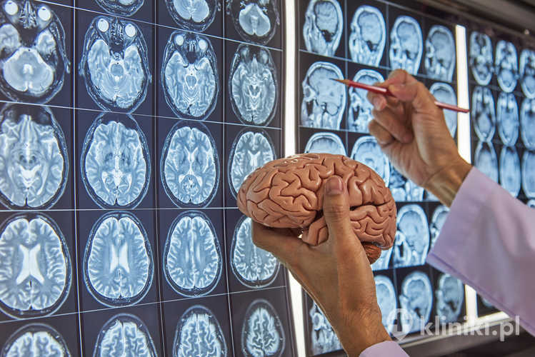 Neurochirurg trzymający model ludzkiego mózgu i wskazujący na MRI mózgu na lightboxie w gabinecie lekarskim