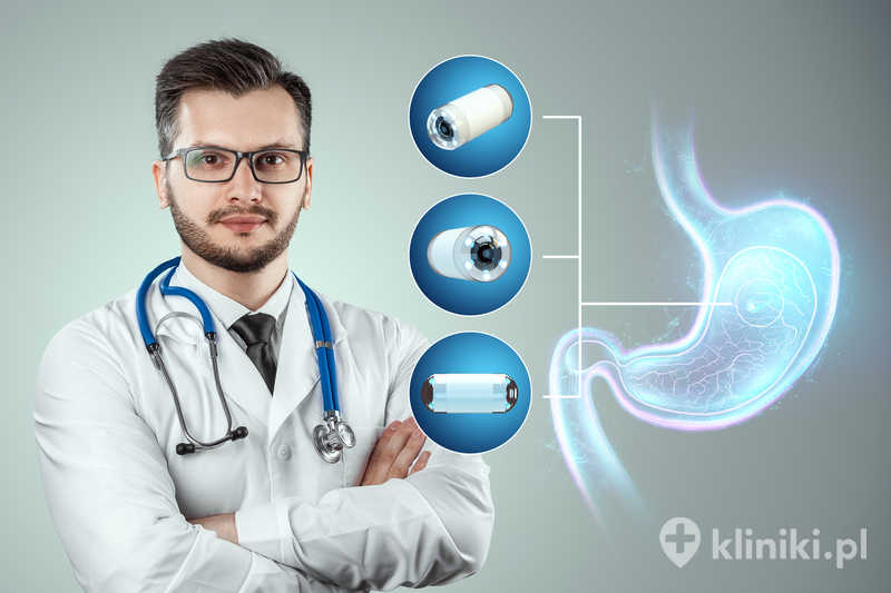 Kapsułka endoskopowa do połknięcia jako alternatywa dla gastroskopii