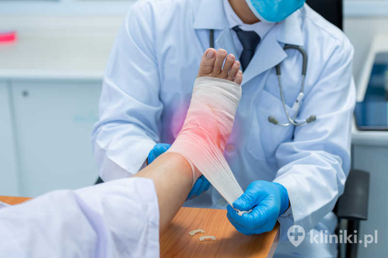 Po operacji pięty lekarz zawiązuje bandaż na nodze pacjentki