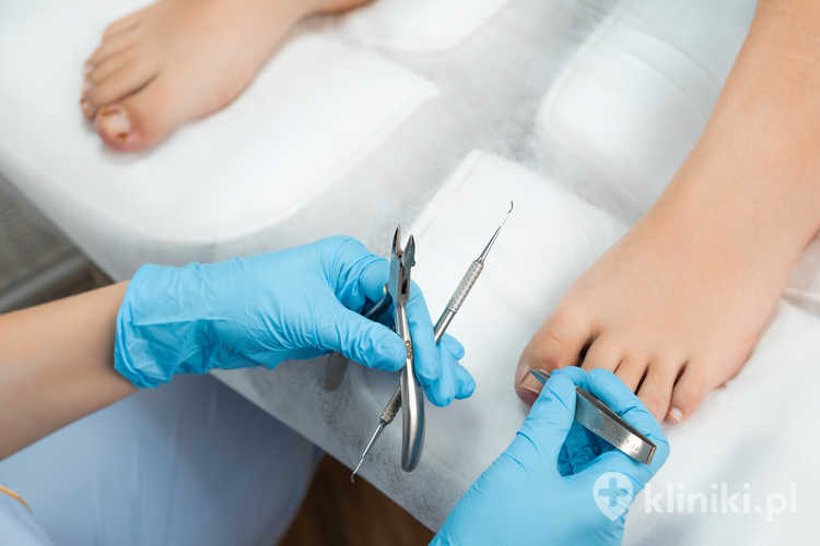 Profesjonalny pedicure medyczny przy użyciu specjalnych przyrządów do paznokci w klinice