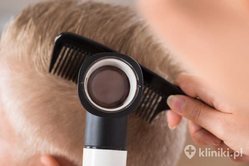 Lekarz badający włosy pacjenta przez dermatoskop