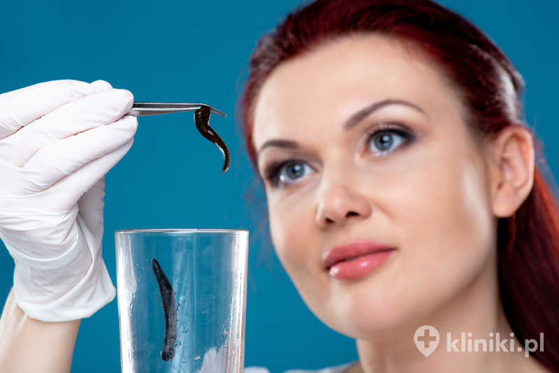 Kobieta lekarz trzyma pęsetą pijawki lekarskie