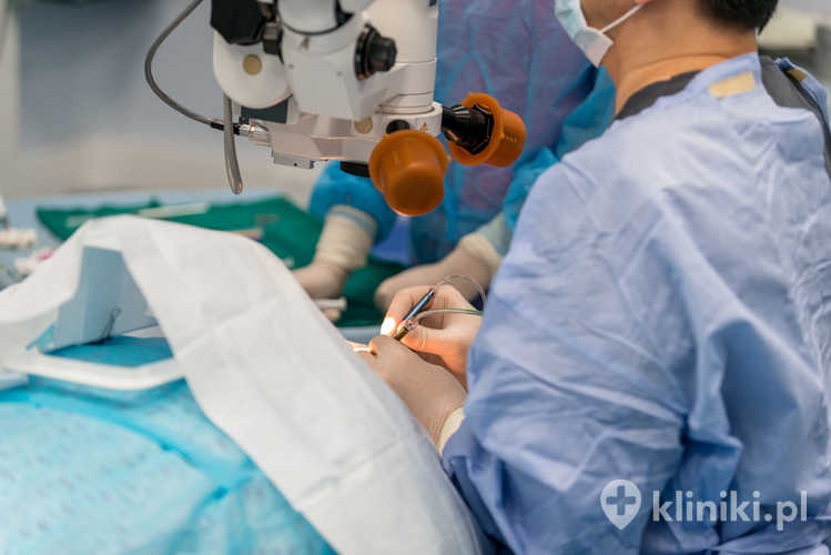 Lekarze są w trakcie przeprowadzania operacji chirurgicznej oka