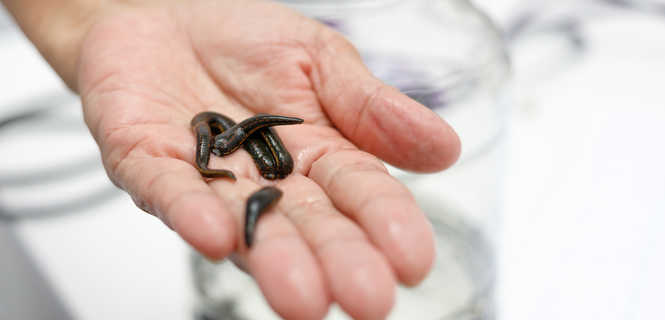 Leczenie pijawkami