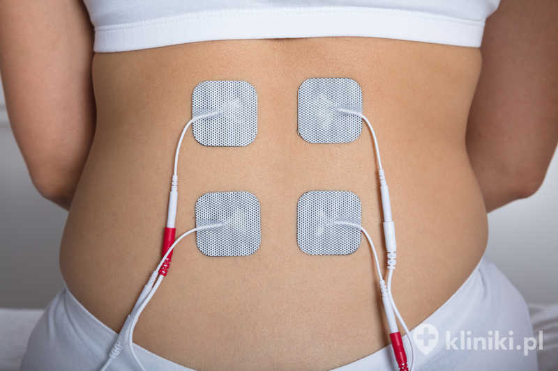 Zbliżenie kobiety z elektrodami elektrostymulatora na plecach