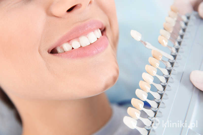 Dentysta wybierający kolor zębów pacjenta za pomocą palety w klinice Dentysta wybierający kolor zębów pacjenta za pomocą palety w klinice