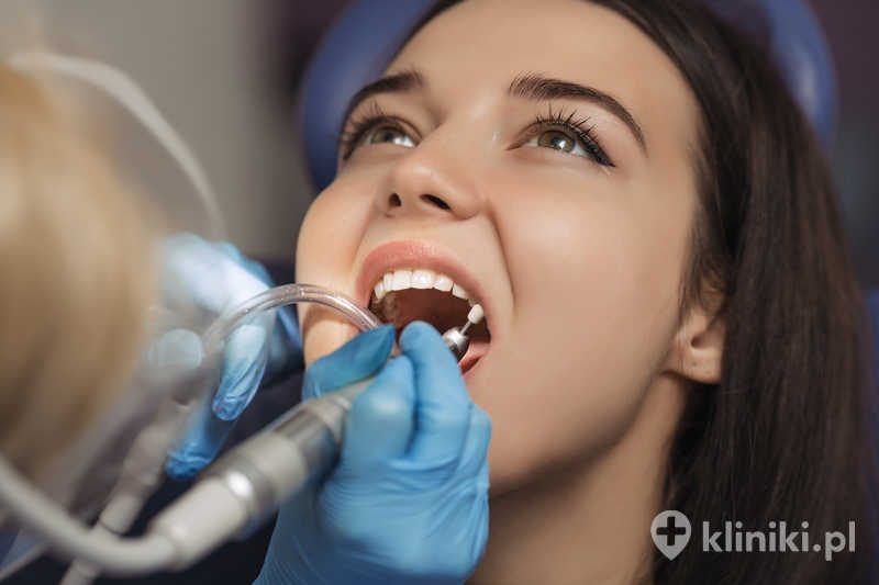Dentysta wykonujący profesjonalne czyszczenie zębów Dentysta wykonujący profesjonalne czyszczenie zębów