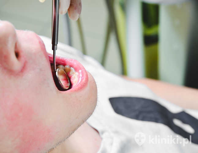 Rodzaje zabiegów osteoplastycznych