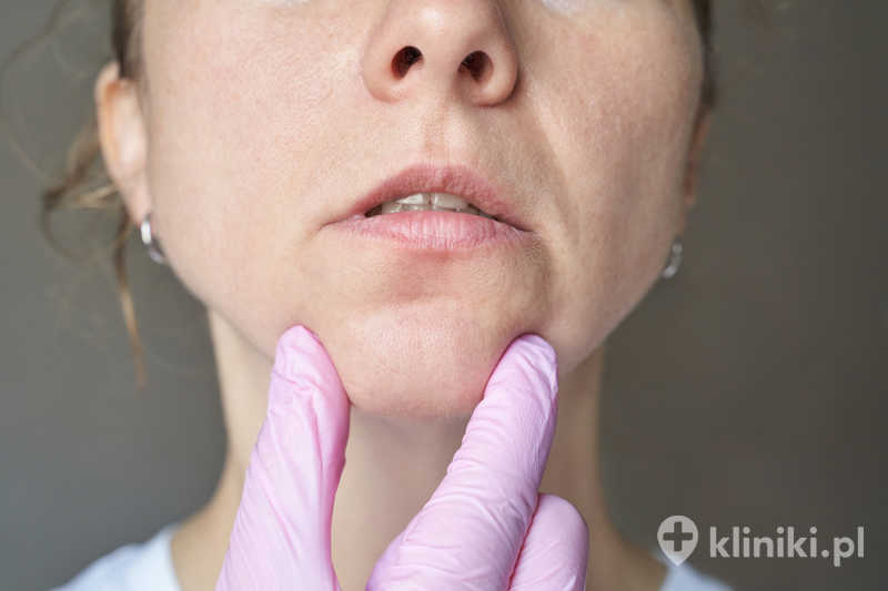 Badanie skóry twarzy dorosłej kobiety