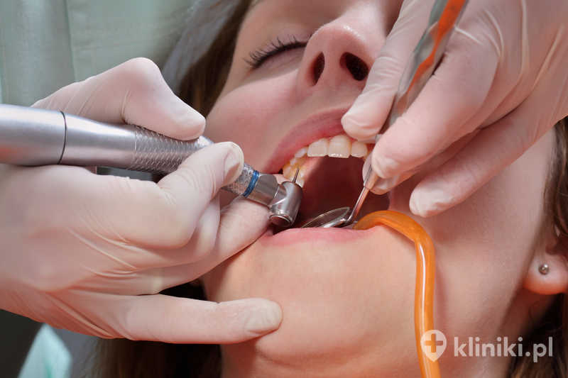 Dentysta wierci ząb młodego pacjenta Dentysta wierci ząb młodego pacjenta