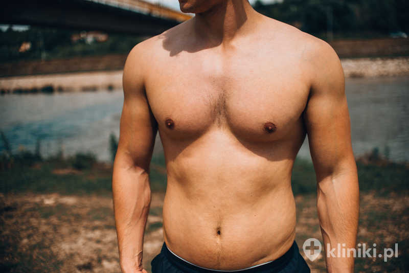 Implanty piersiowe u mężczyzn pozwalają osiągnąć trwały efekt muskularnej, harmonijnej sylwetki Implanty piersiowe u mężczyzn pozwalają osiągnąć trwały efekt muskularnej, harmonijnej sylwetki