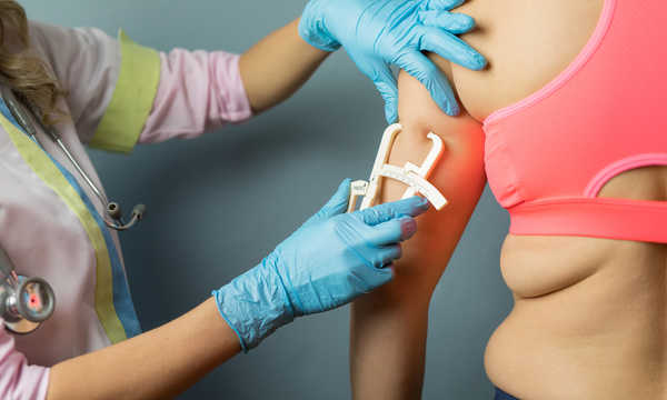 Lekarz dietetyk dokonujący pomiarów tkanki tłuszczowej pacjenta na ramieniu za pomocą suwmiarki