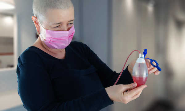 Usunięcie drenu pooperacyjnego