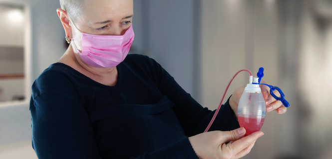 Usunięcie drenu pooperacyjnego