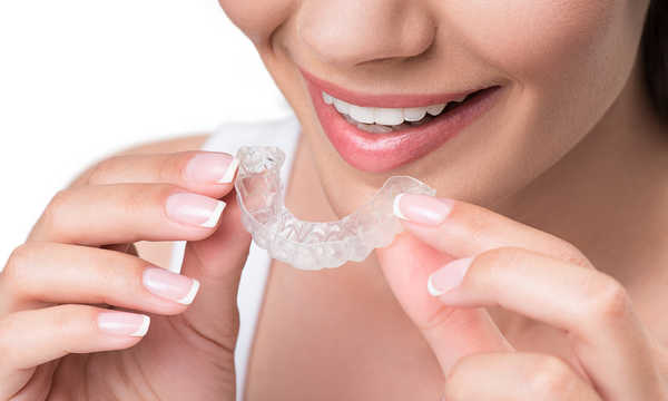 Wybielanie zębów metodą nakładkową polega na stosowaniu specjalnych nakładek wypełnionych żelem wybielającym Wybielanie zębów metodą nakładkową polega na stosowaniu specjalnych nakładek wypełnionych żelem wybielającym