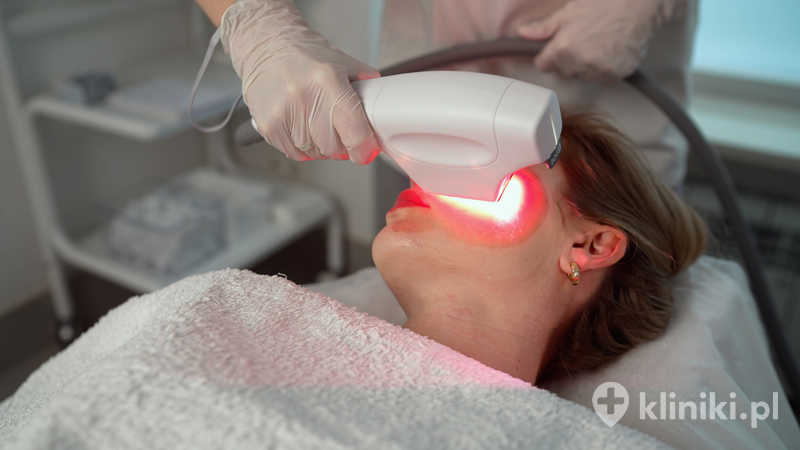 Laserowe zamykanie naczyń