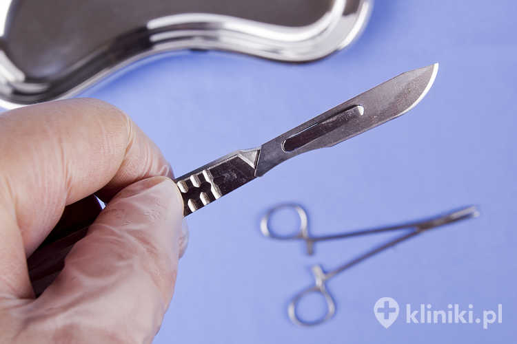 Necrectomia ambulatoryjna