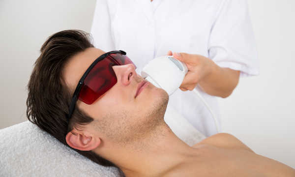 Depilacja laserowa baków – gładkie policzki bez podrażnień