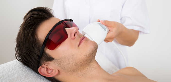 Depilacja laserowa baków – gładkie policzki bez podrażnień