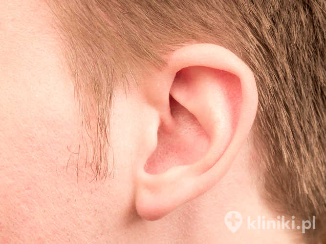 Depilacja laserowa baków