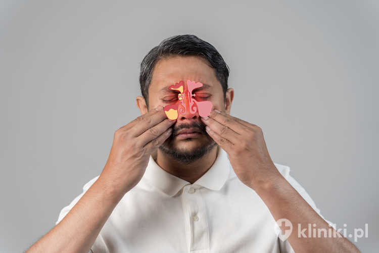 Tomografia zatok jest szczególnie zalecana przed operacjami endoskopowymi nosa oraz w diagnostyce przewlekłego zapalenia zatok