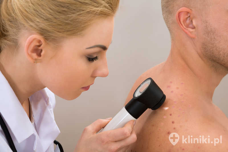 Kobieta lekarz badający napigmentowaną skórę mężczyzny za pomocą dermatoskopu Kobieta lekarz badający napigmentowaną skórę mężczyzny za pomocą dermatoskopu