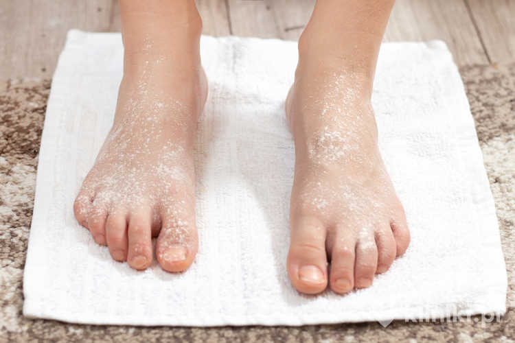 leczenie nadpotliwości stóp botoksem