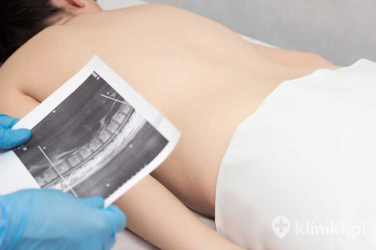 Lekarz robi zdjęcie MRI pleców dziewczyny, która ma ból pleców