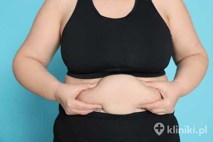 Podczas konsultacji lekarz analizuje wyniki badań, styl życia oraz wcześniejsze próby leczenia otyłości