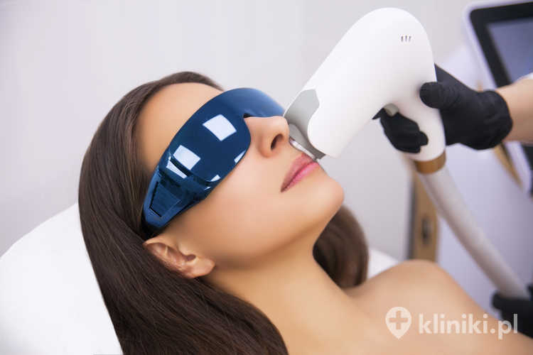 przebieg zabiegu IPL