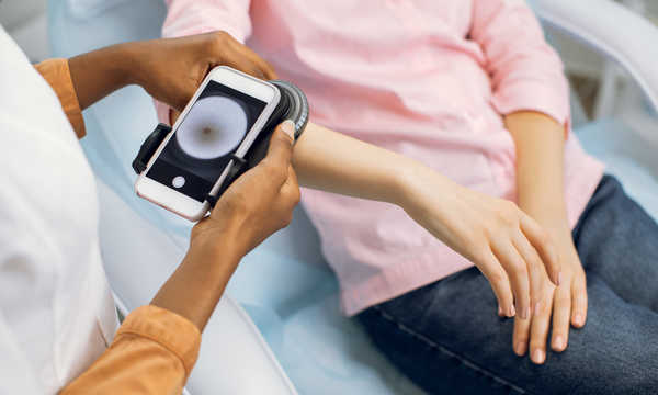 Zbliżenie dłoni lekarki-dermatologa-onkologa trzymającej dermatoskop nowej generacji, badającej znamiona Zbliżenie dłoni lekarki-dermatologa-onkologa trzymającej dermatoskop nowej generacji, badającej znamiona